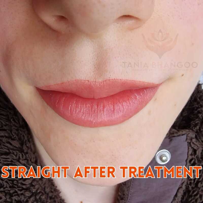 lip blush straight after treatment