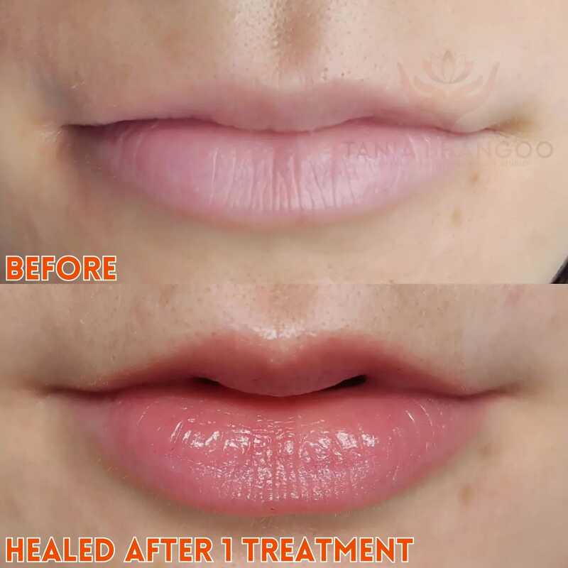 lip blush before and healed