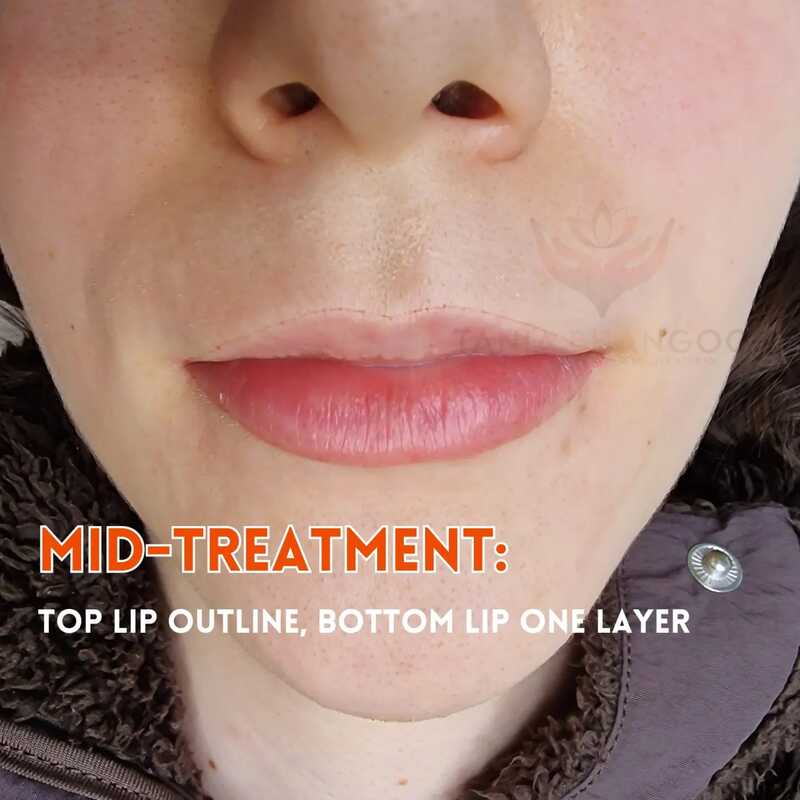 lip blush mid treatment